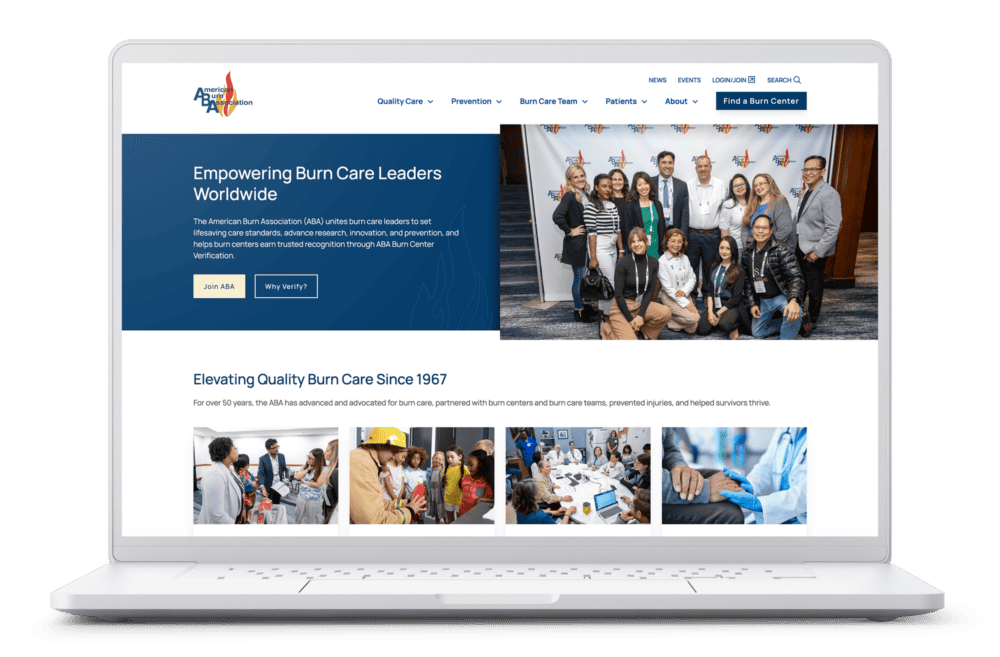 Laptop displaying the American Burn Association website homepage with featured content about burn care leadership, prevention, and education.
