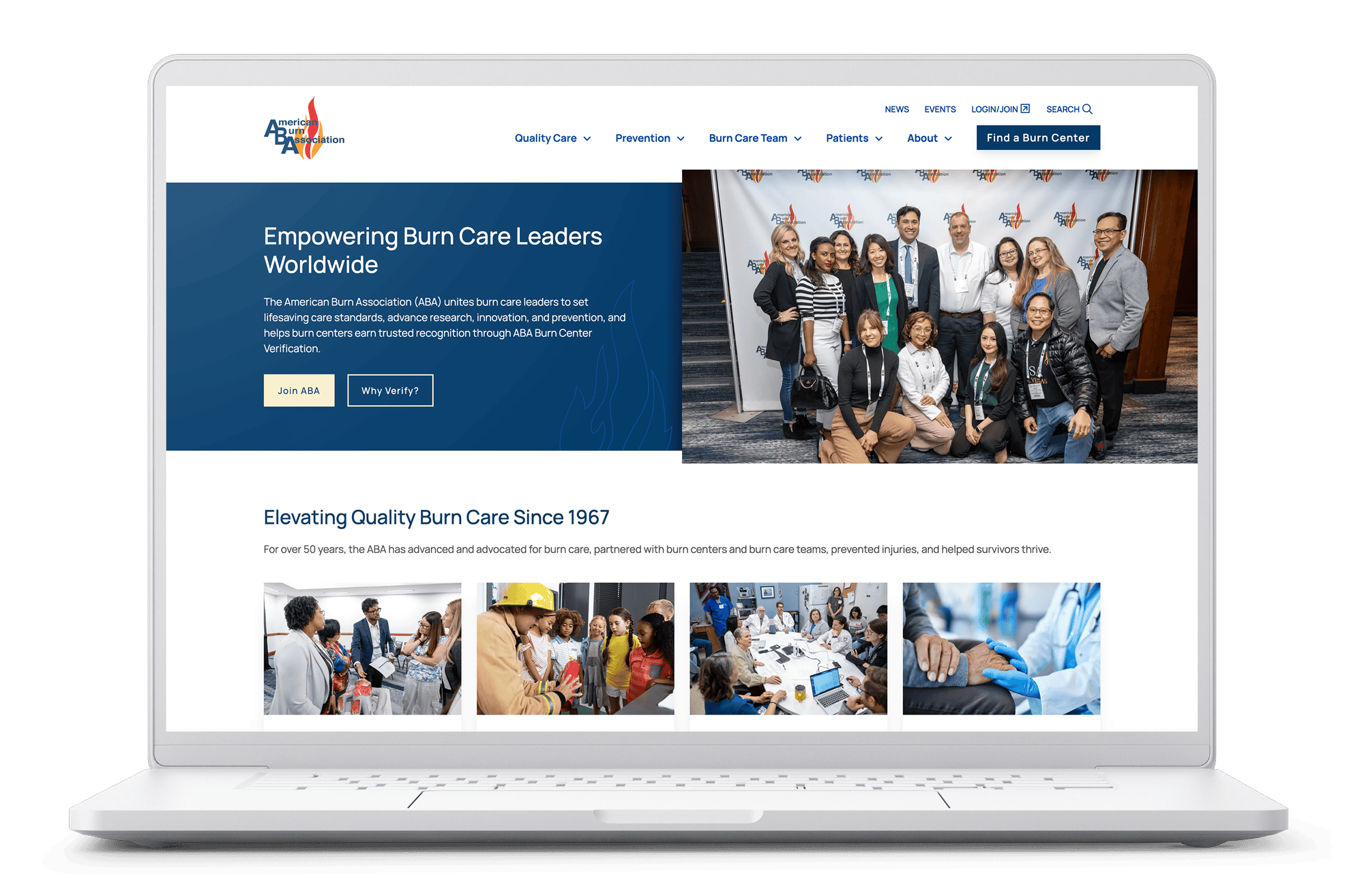 Laptop displaying the American Burn Association website homepage with featured content about burn care leadership, prevention, and education.